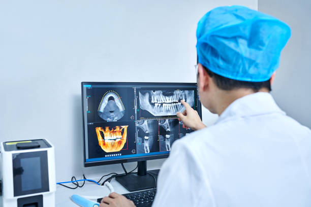 Best Emergency Root Canal Treatment in Port Barre, LA