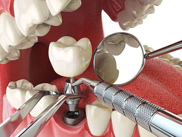 Best Urgent Dental Care in Port Barre, LA